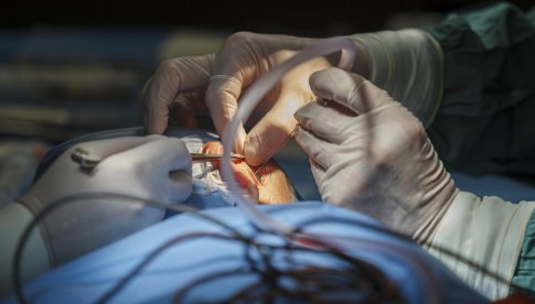 operacje implantów słuchowych